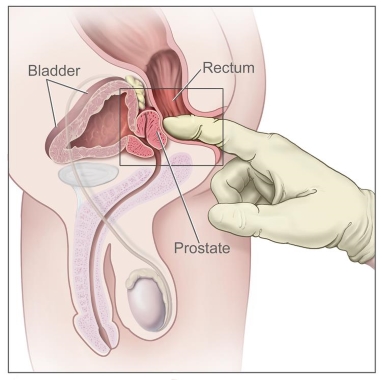 internal prostate massage